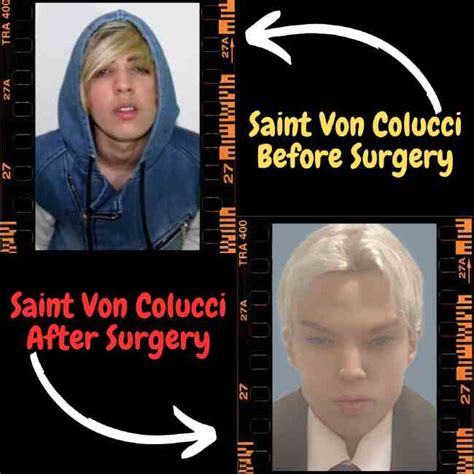 saint von colucci|saint von colucci before surgery.